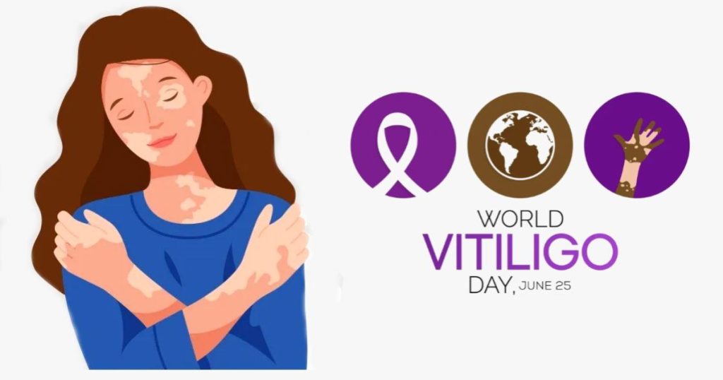 Vitiligo FI4 1